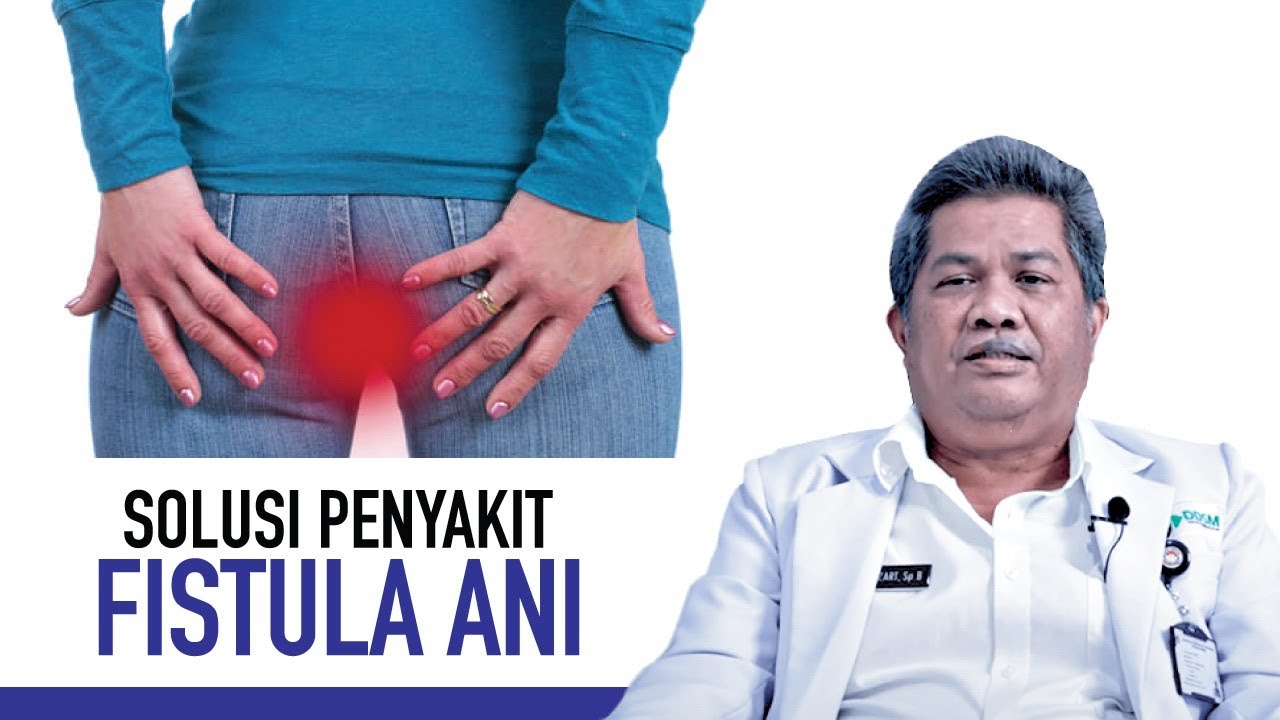 Fistula Ani: Penyebab, Gejala dan Cara Mengatasi | Kata Dokter