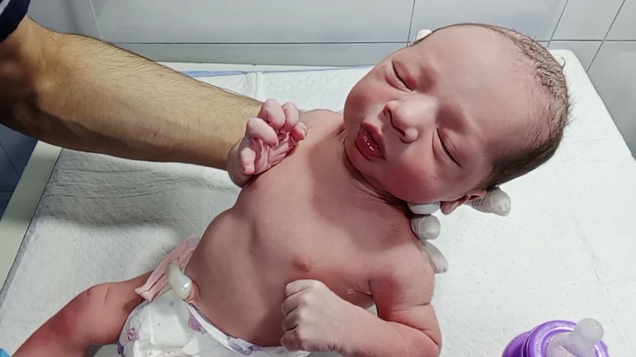 MSL Grade II Baby Recovery | Start First Feeding Trial in NICU#nicu monitoring#babycare#babyhealth 