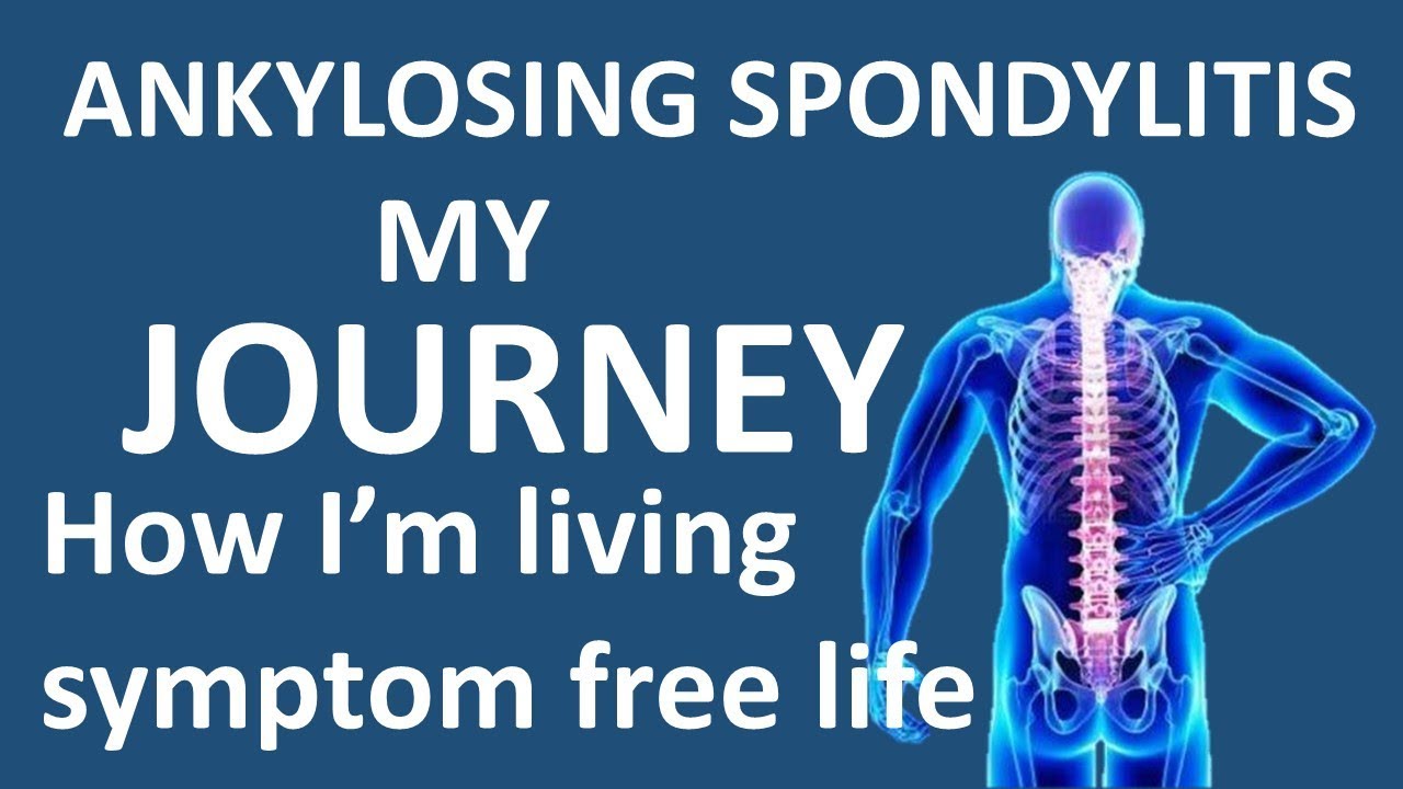 [HINDI-हिन्दी] Ankylosing Spondylitis Journey - How I'm living symptom free life || HLA-B27+