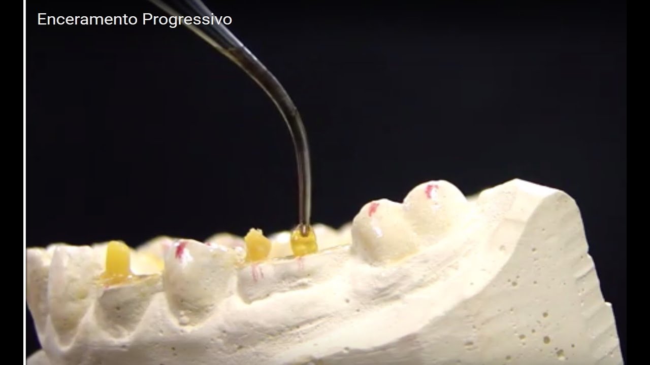 Enceramento Progressivo