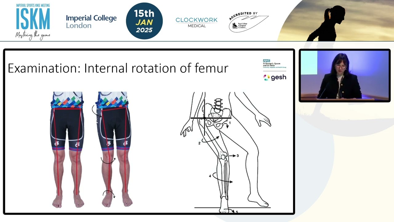 Assessing a Patient with Patellofemoral Joint Dislocation | Prof Caroline Hing