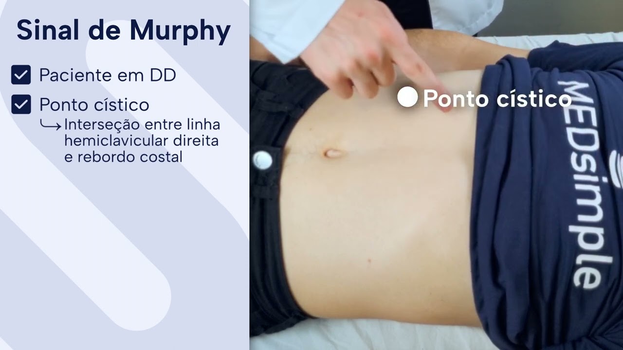 Sinal de Murphy: Exame F&iacute;sico do Abdome