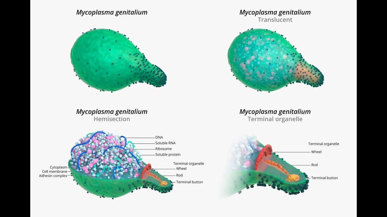 Mycoplasma genitalium ; sexually transmitted bacterium, Diagnosis, Treatment