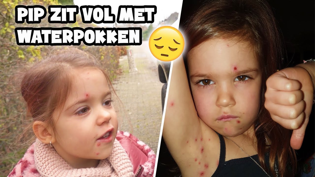 PIP HEEFT WATERPOKKEN !! - De Bakkertjes #640