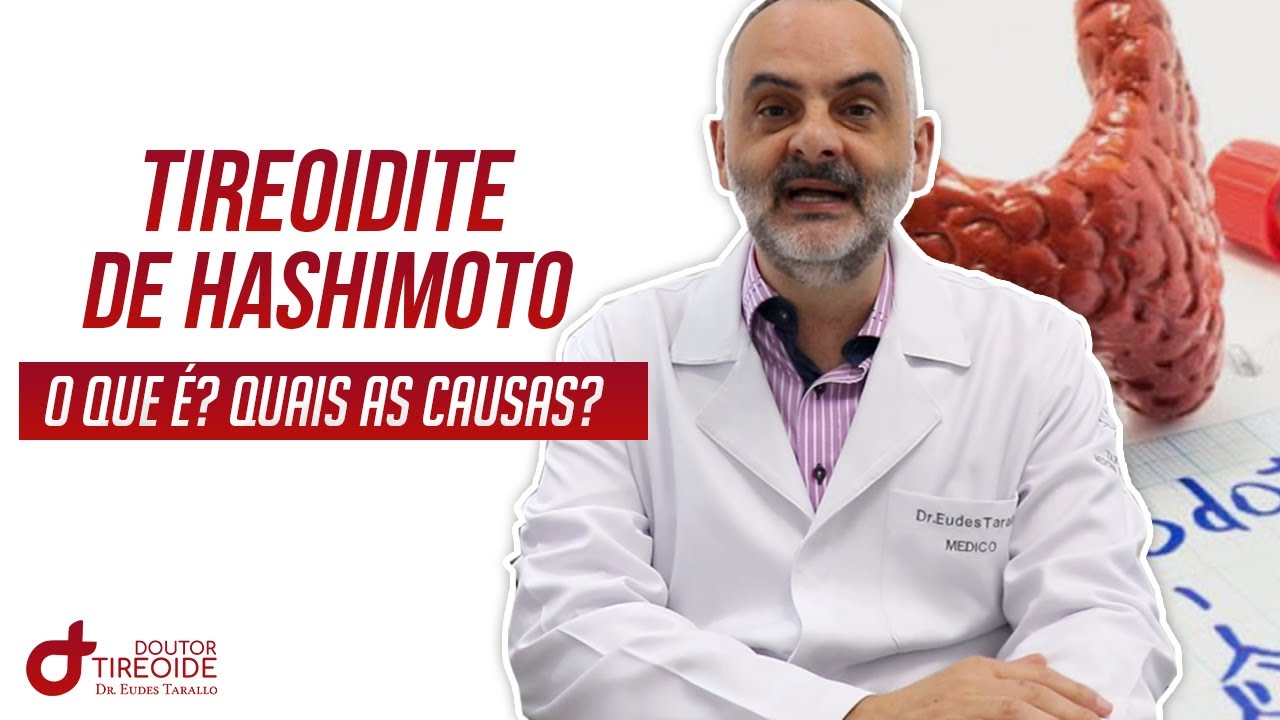 Tireoide de Hashimoto! O que é? Quais as causas? | Dr Eudes Tarallo | Doutor Tireoide