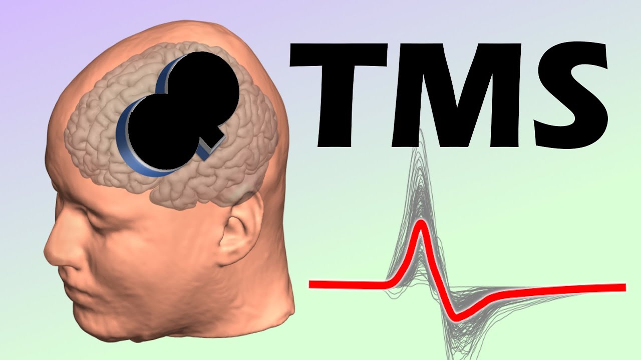 Transcranial magnetic stimulation (TMS) over the motor cortex