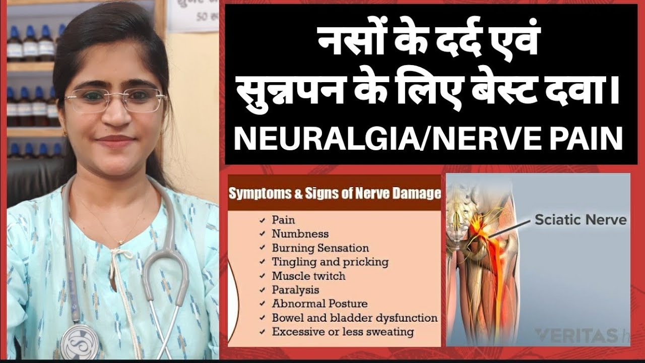 Nerve pain treatment।।नसों के दर्द के लिए बेस्ट दवा।।Homeopathic medicine