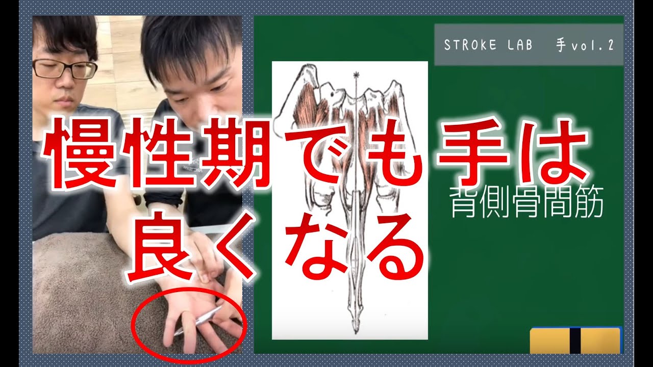 30分間ひたすらに片麻痺の手の治療/作業療法士upper extremity exercises for stroke patients