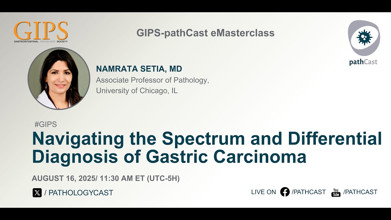#GIPS Navigating the Spectrum and Differential Diagnosis of Gastric Carcinoma