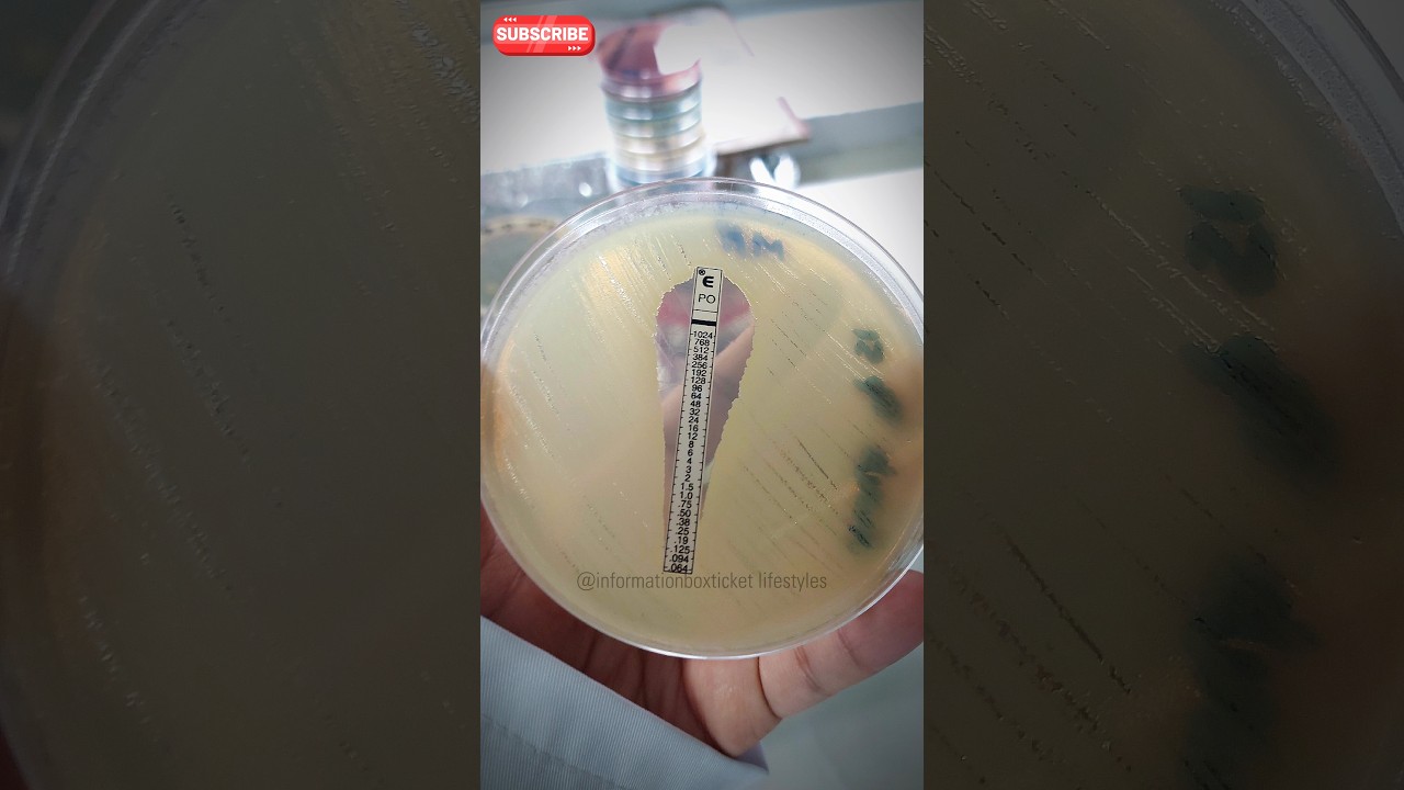 E-test Explained: Determining MIC with Polymyxin (PO) 🔬 | #Microbiology #Antibiotics #Shorts