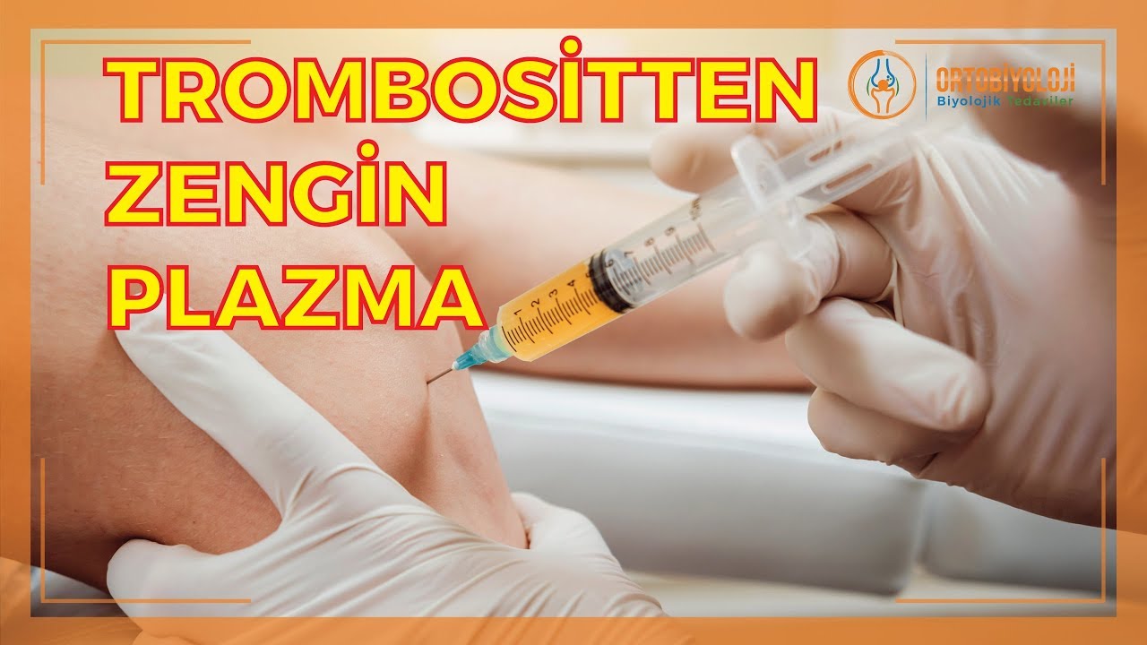 TROMBOSİTTEN ZENGİNLEŞTİRİLMİŞ PLAZMA NEDİR?