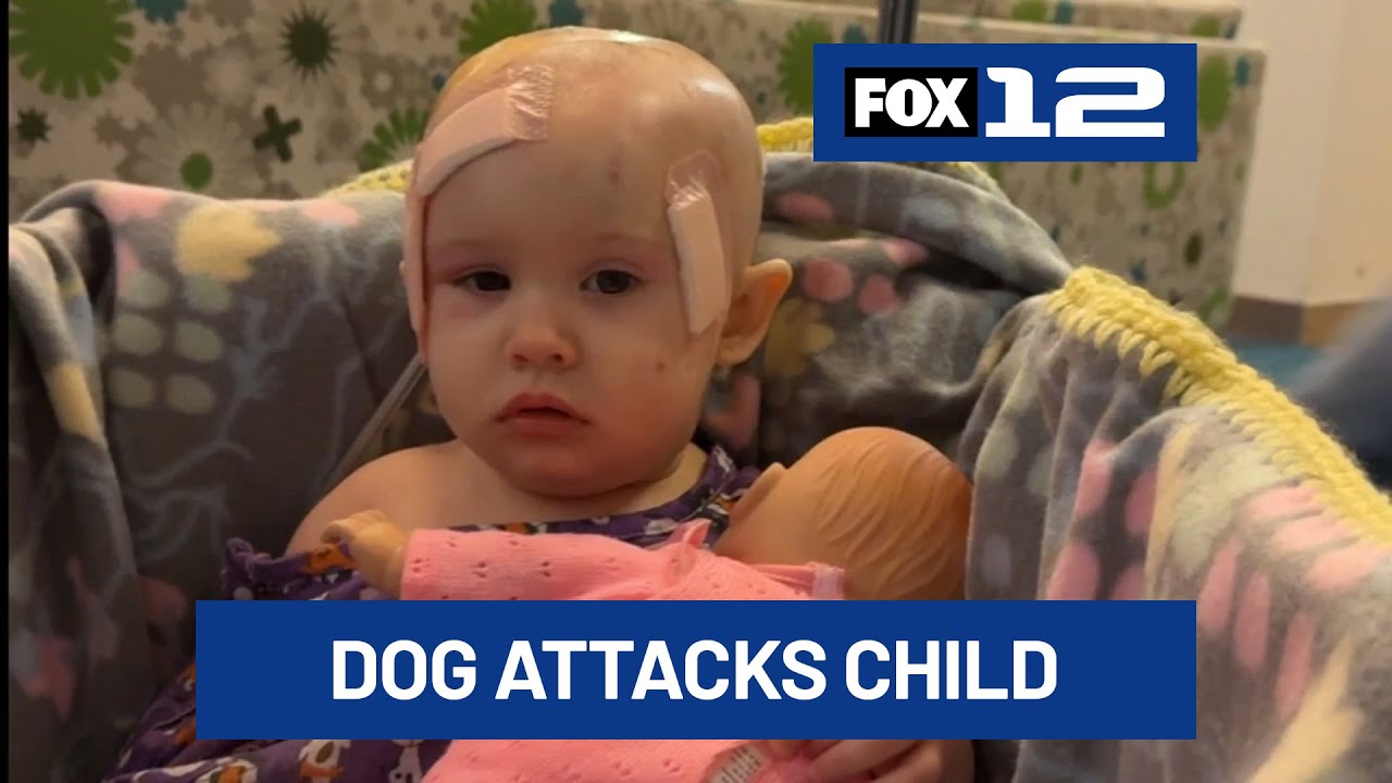 1-year-old child attacked by two pit bulls in Salem, suffers serious head injury