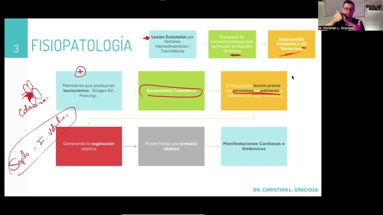 Endocarditis