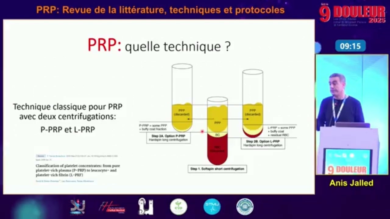 Plasma Riche en Plaquettes (PRP) ‐ Revue de la littérature, techniques et protocoles