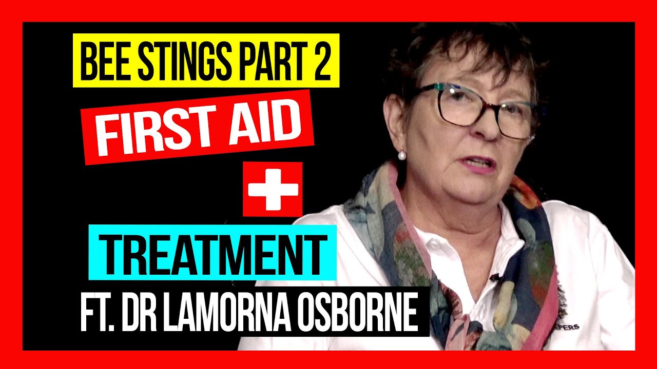 Bee Stings (Part 2) First Aid & Treatment