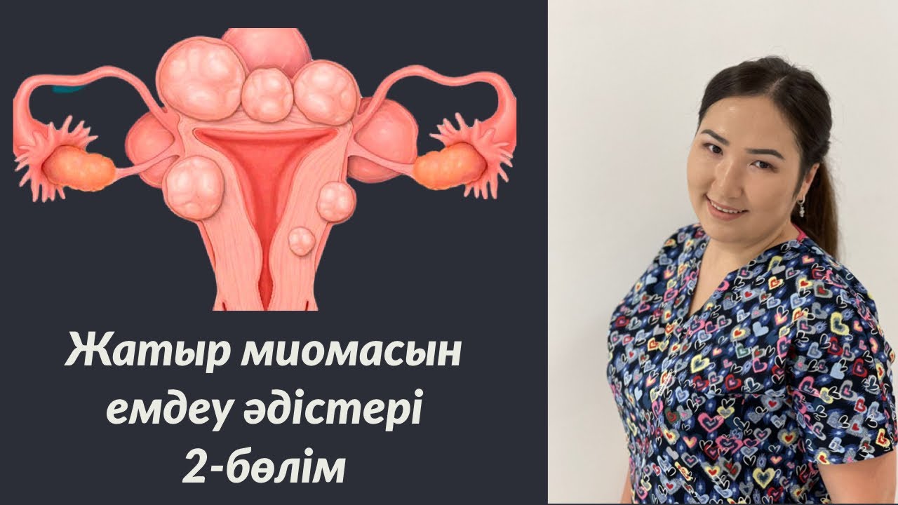 Миоманың емі