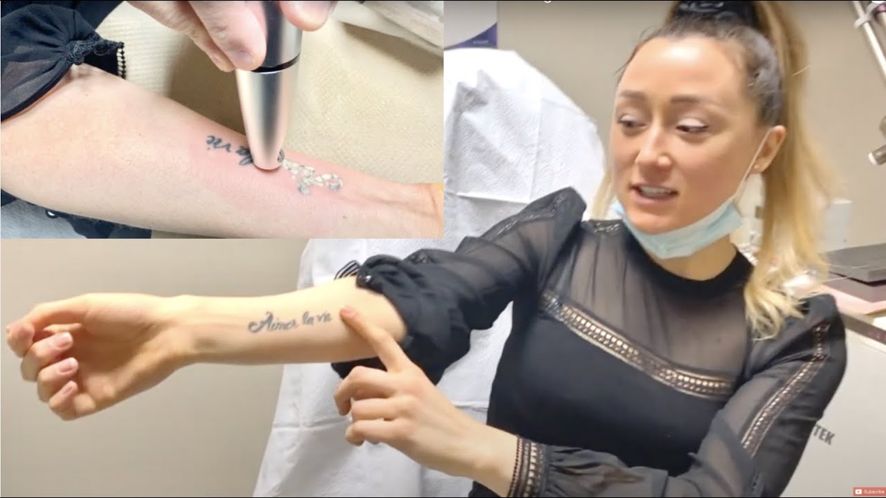 Laser Tattoo Removal LIVE SESSION | Cost, Pain Level & WHY I'm Getting It Removed