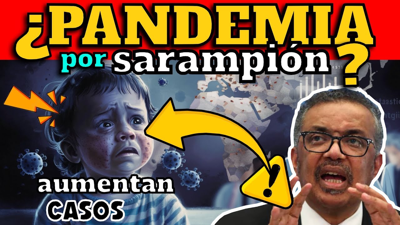 ¡ALERTA!  ¿RIESGO DE PANDEMIA POR SARAMPIÓN?