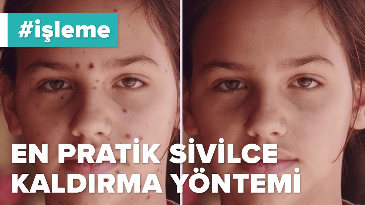 En Pratik Sivilce Temizleme, Kaldırma, Silme Yöntemi | Lightroom, Photoshop