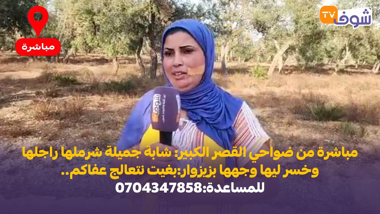مباشرة من ضواحي القصر الكبير: شابة جميلة شرملها راجلها وخسر ليها وجهها بزيزوار:بغيت نتعالج عفاكم.