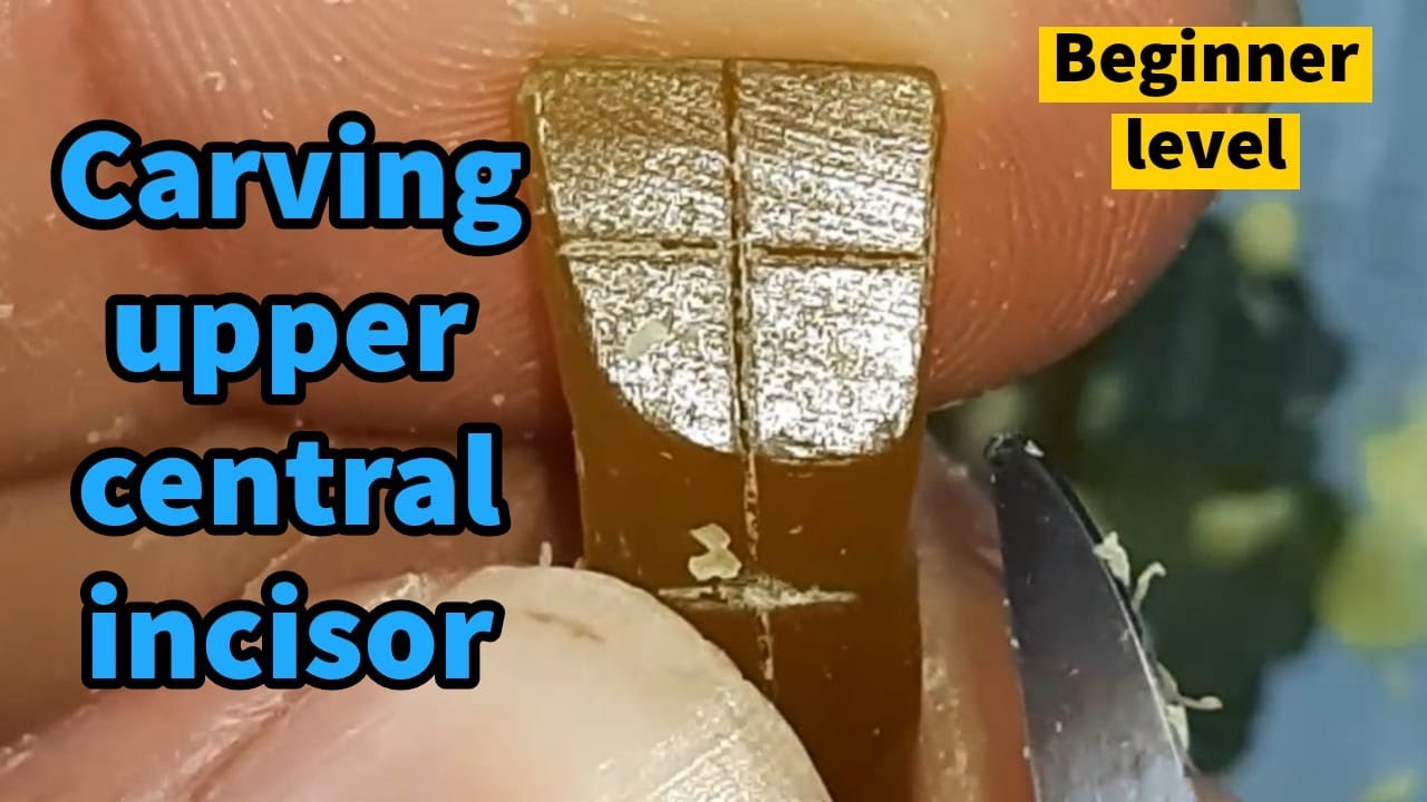 upper central incisor carving 2024