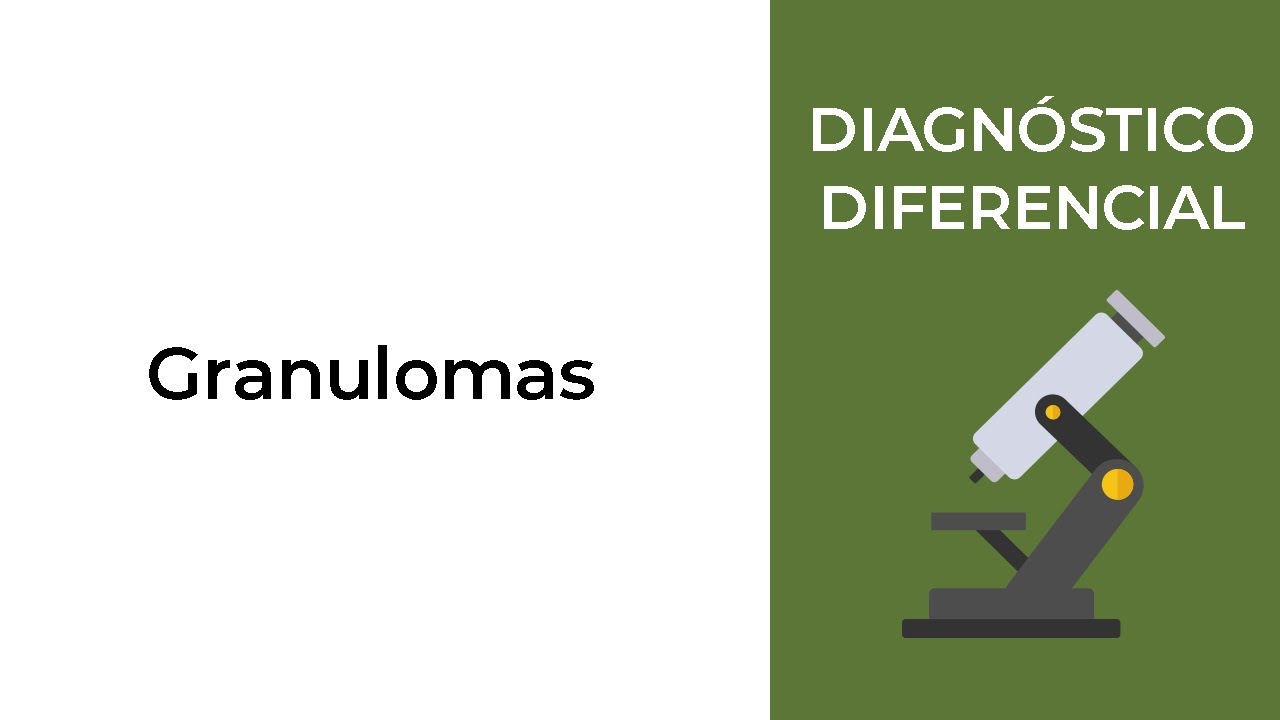 Granulomas. Diagnostico diferencial