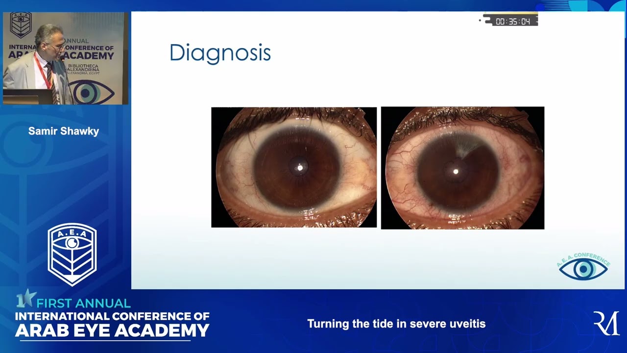 Panel Discussion: Turning the Tide in Severe Uveitis