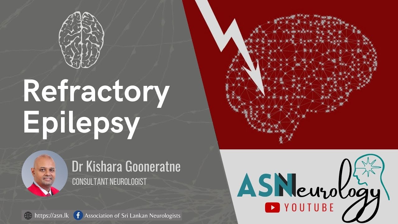 Refractory Epilepsy by Dr Kishara Gooneratne