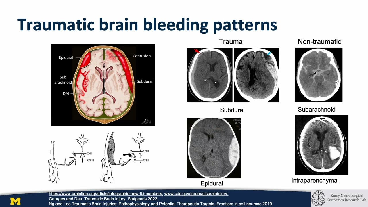 1. Emergency neurosurgery  - Overview of neurosurgical emergencies