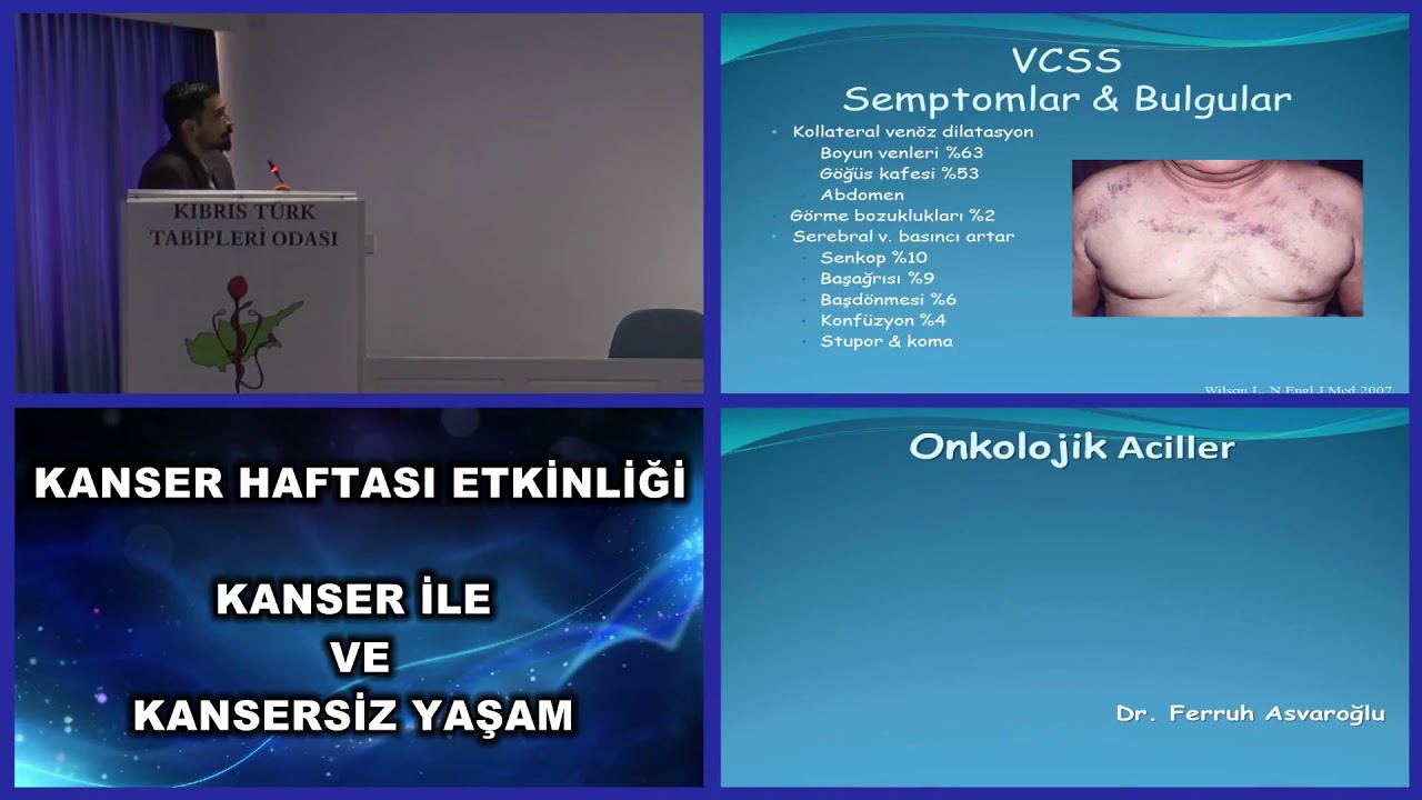 DR. FERRUH ASVAROĞLU ONKOLOJİK ACİLLERE YAKLAŞIM