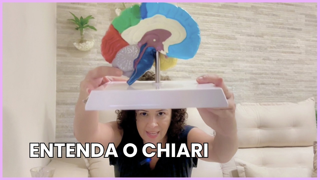 O QUE É A SINDROME DE ARNOLD CHIARI TIPO 1? Minha explicação como paciente.