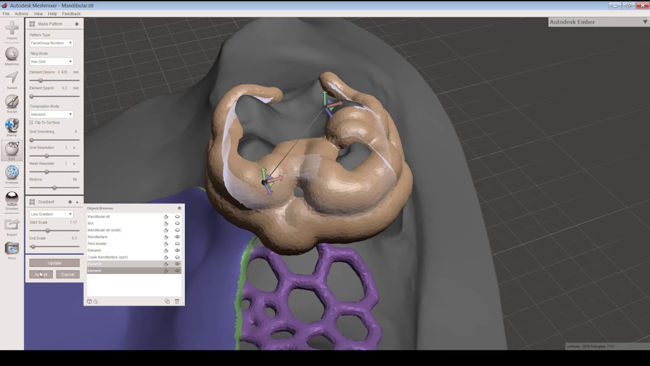 Come creare elementi complessi per odontoiatria con Autodesk Meshmixer