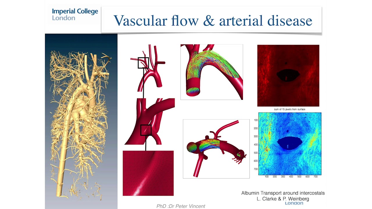 Arteries and algorithms