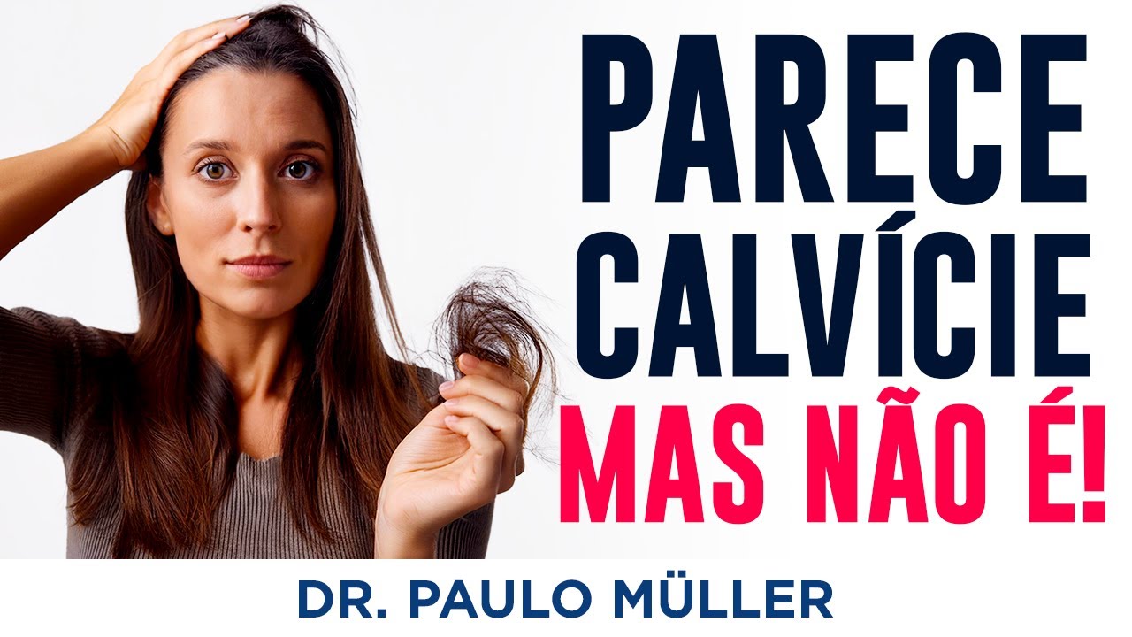 FAPD – Parece Calvície, MAS NÃO É! - Dr. Paulo Müller Dermatologista