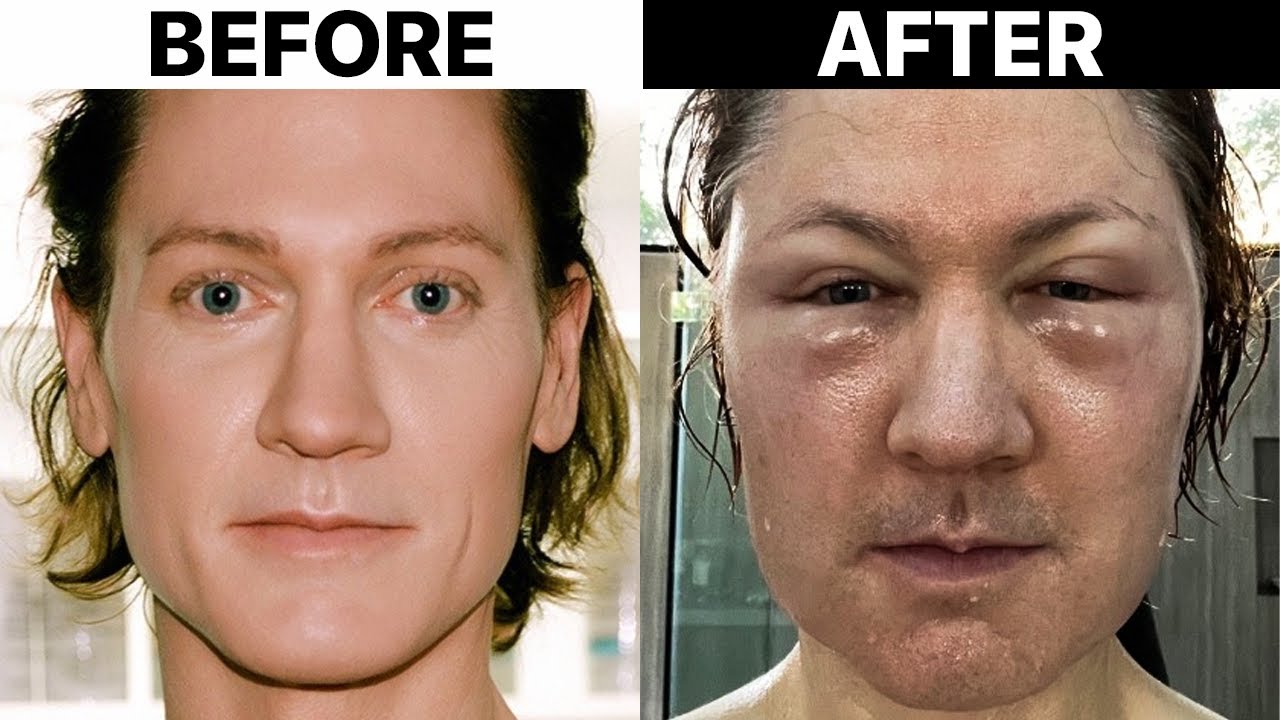 He Tried To Make His Face Look Younger... Surgeon Reacts