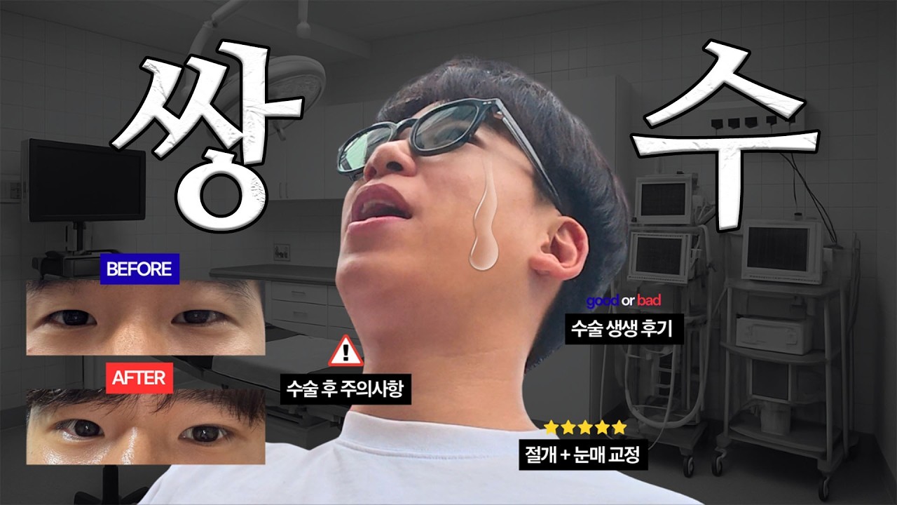 쫄보의 쌍수 당일 브이로그 | 방금 수술한 사람이 들려주는 쌍수썰 | 절개+눈매교정