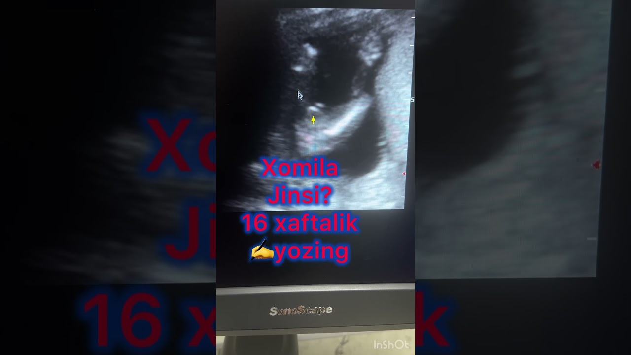Xomila jinsi? 16 xaftalik 