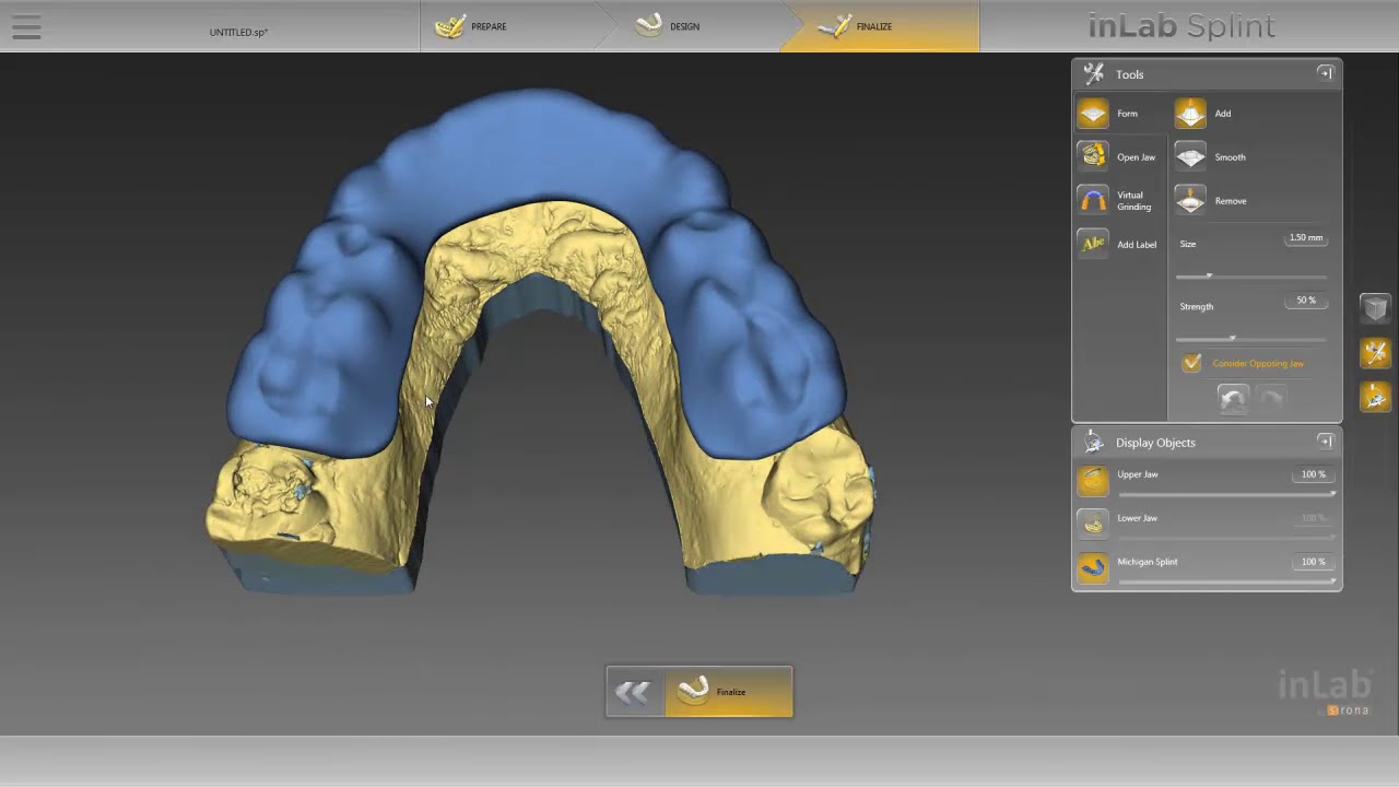 How to Fabricate Michigan Splint Inlab