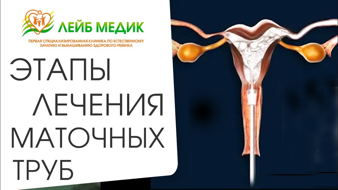 🤰 Комплексное лечение патологий маточных труб. Лечение маточных труб. Лейб Медик. 12+