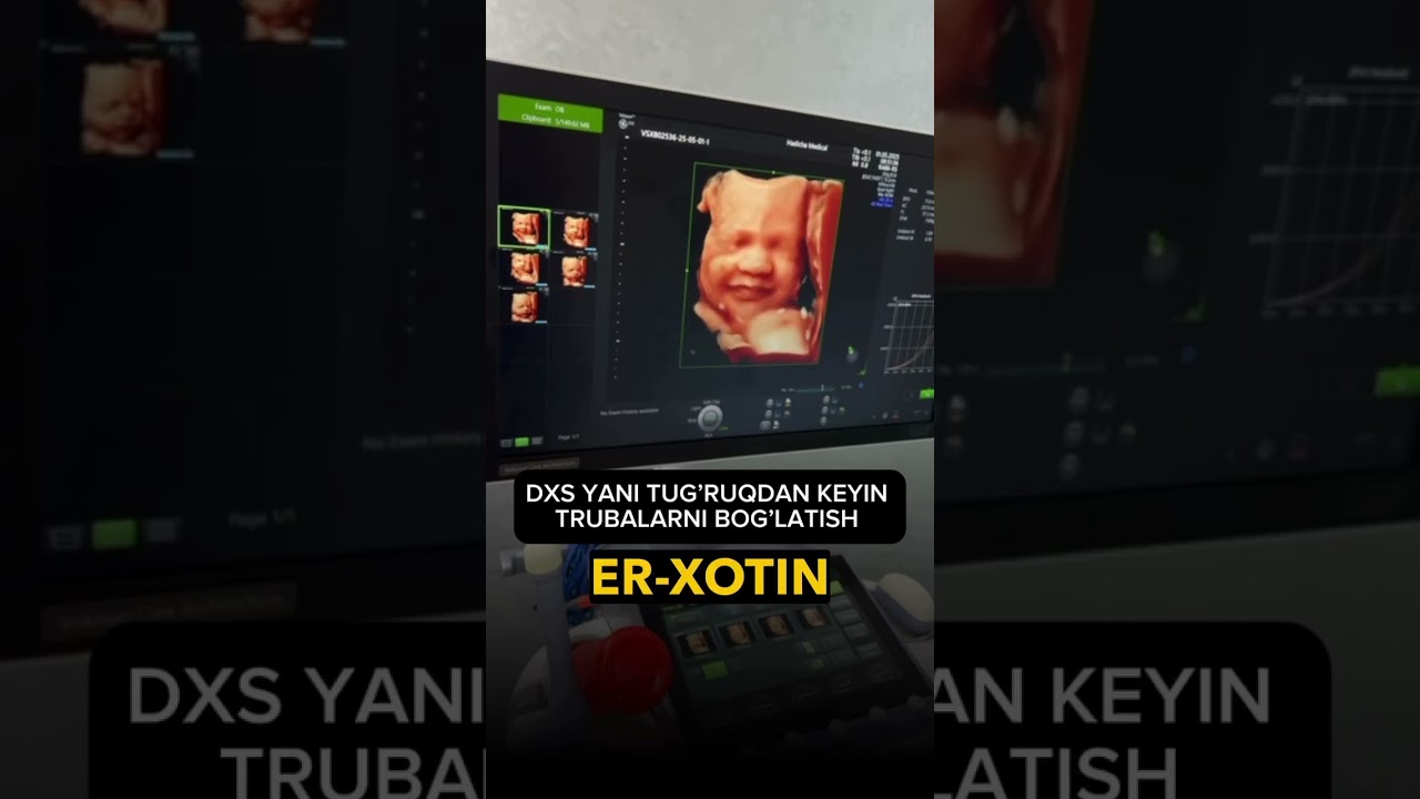 DXS Yani tug’ruqdan keyin Truba bog’latish… 