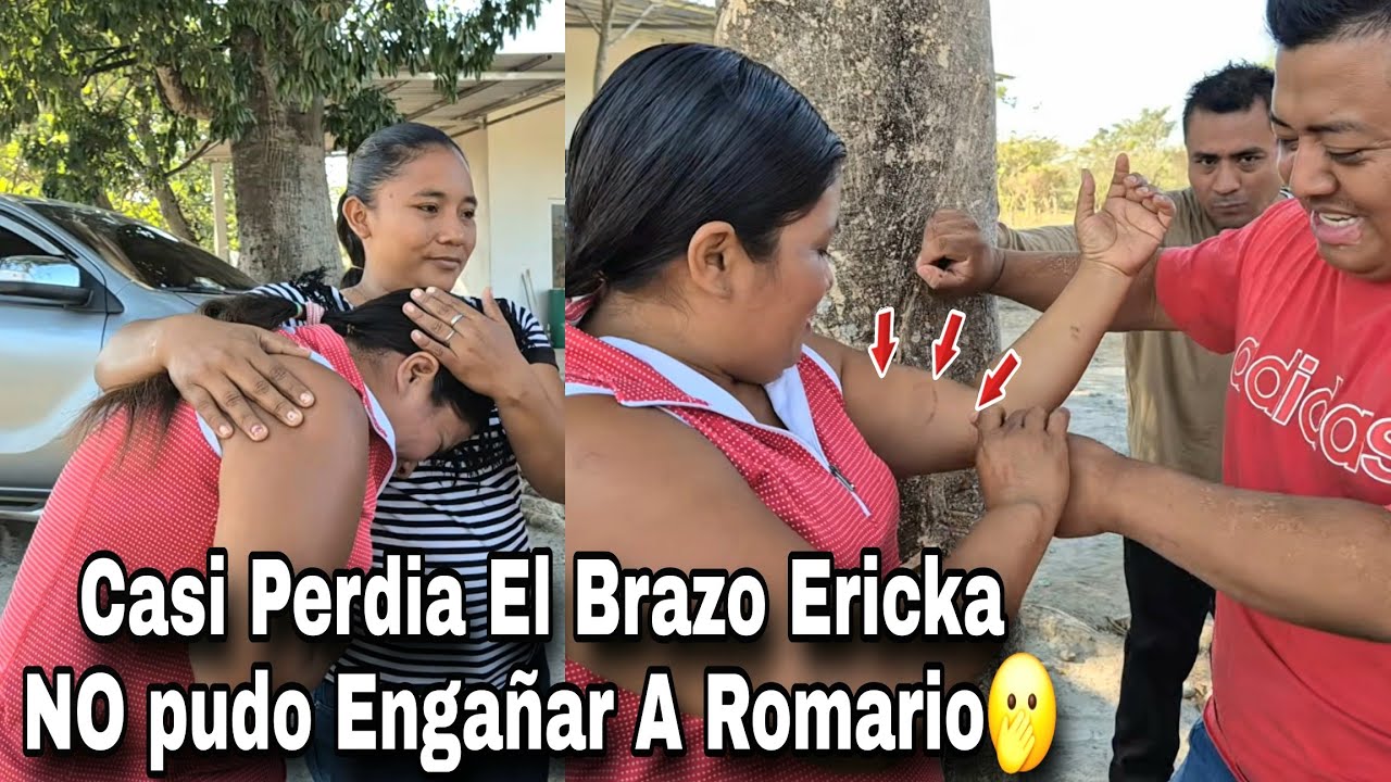 Ericka Llego Con Esta Mordida Un Perro Pitbull Orejon Chimuelo Fue Dice Llorando Amargamente🫢