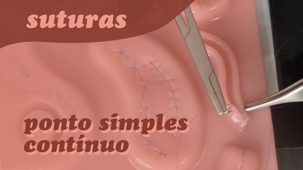 Suturas | Ponto Simples Contínuo