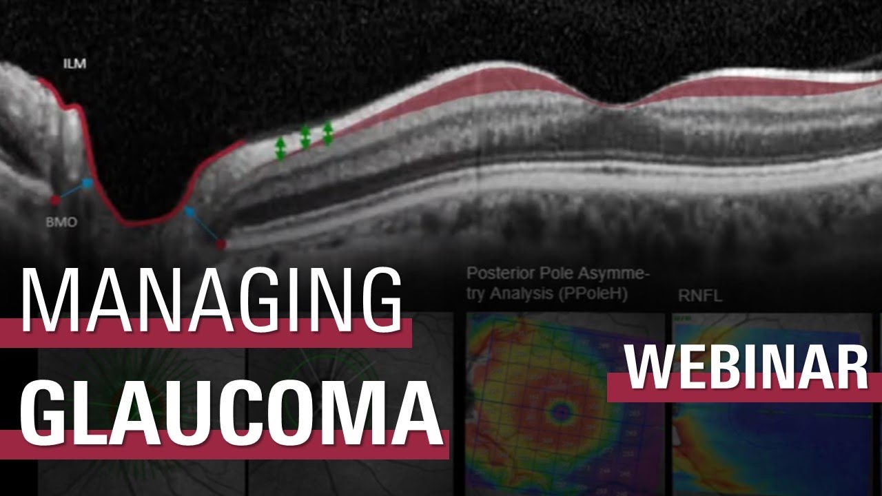 Managing Glaucoma Patients with Confidence