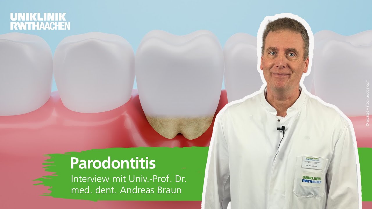 Parodontitis: Prof. Andreas Braun beantwortet die wichtigsten Fragen