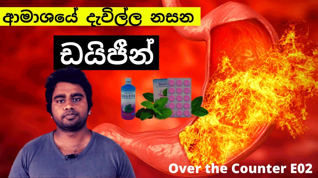 ගැස්ට්‍රයිටිස් වලට හපලා කන පෙත්ත - ඩයිජීන් ගැන හැමදෙයක්ම | Over The Counter E02 - Digene