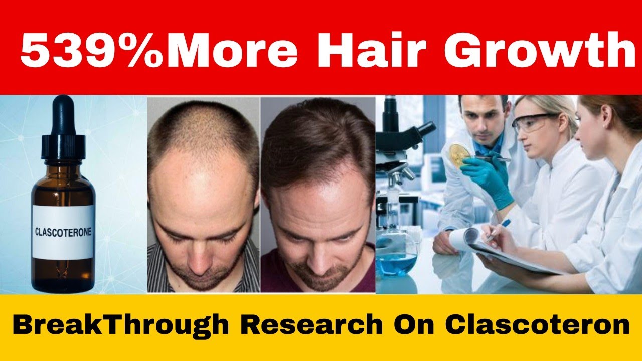 Clascoterone (Breezula). Hair loss Treatment.#Clascoterone