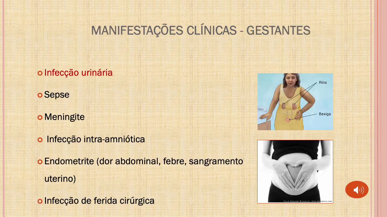 Streptococcus agalactiae - UFC Famed Sobral