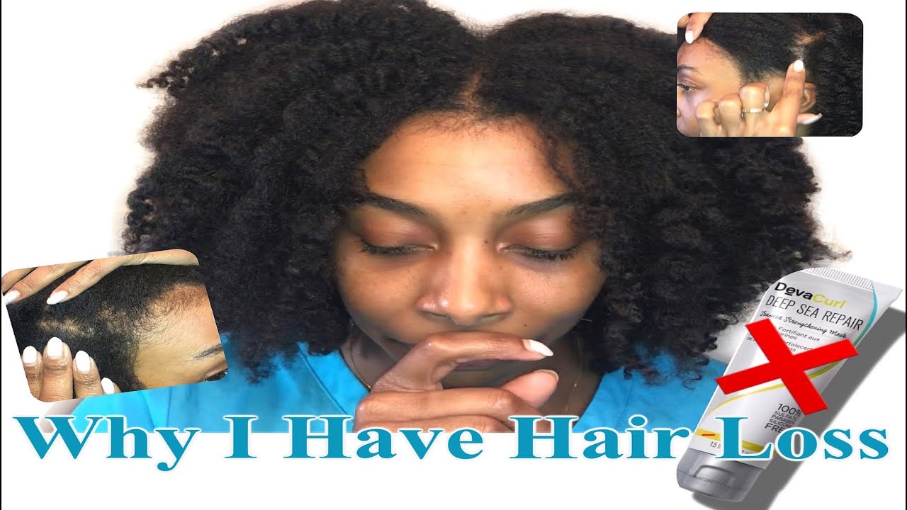 My Devacurl Hair Loss, Why It Happened | XO_Rocky
