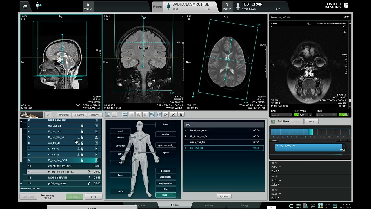 D T I MRI.(UNITED IMAGING)