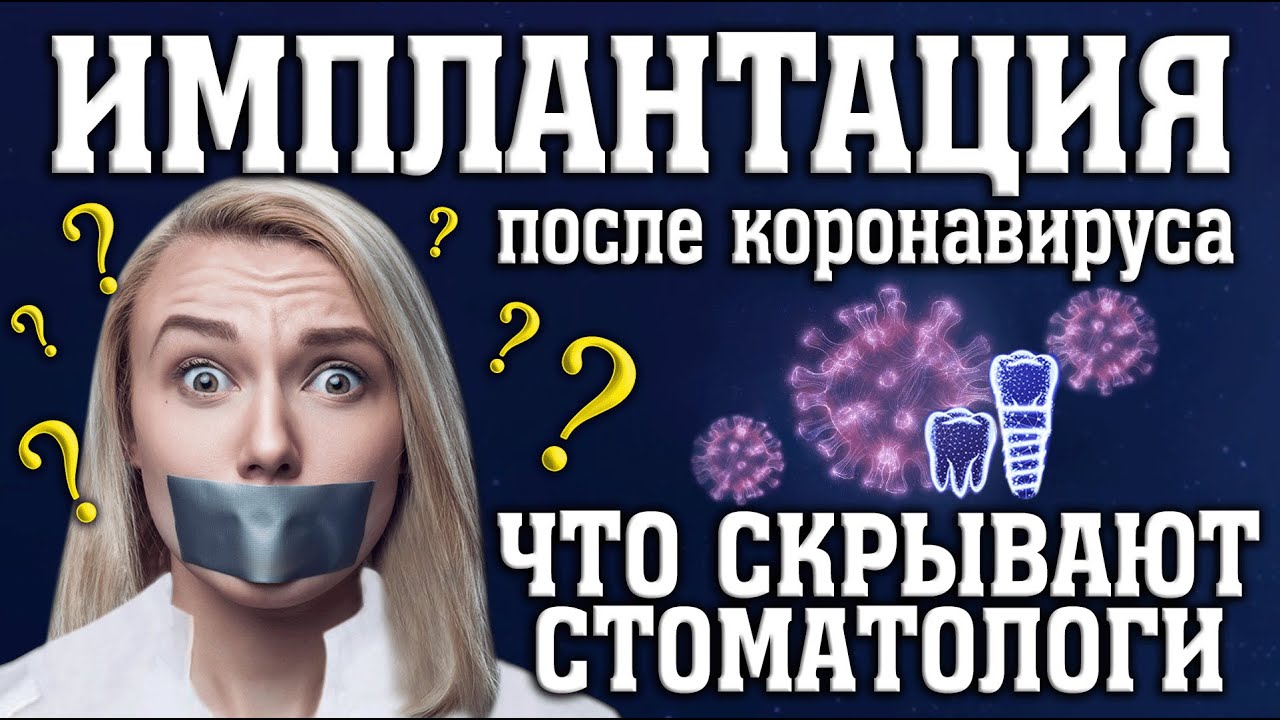 Имплантация после коронавируса. Что скрывают стоматологи?